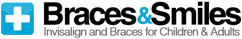 Braces and Smiles